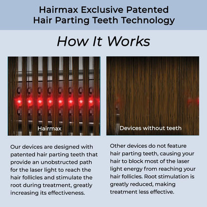 HairMax ULTIMA 12 LaserComb - Stimulates Hair Growth, Reverses Thinning, Regrows Fuller More Vibrant Hair