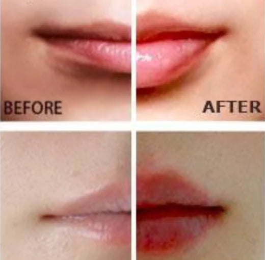 Miracle Lip Plumper - Hyaluronic Acid Lip Volumizer for Fuller Lips